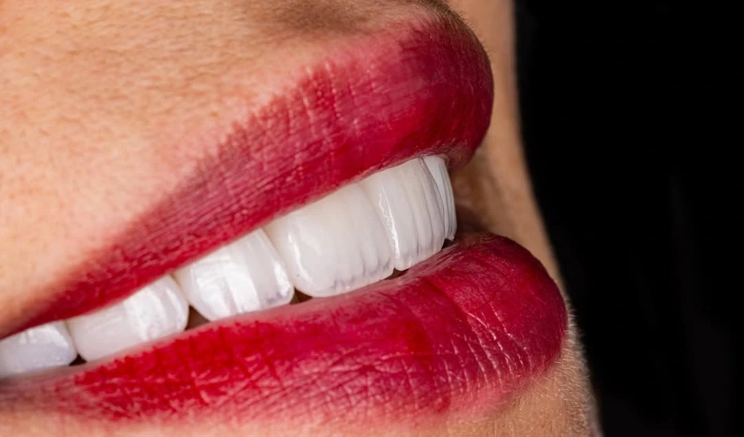 After - Denta precision craftsmanship